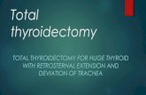 Total thyroidectomy