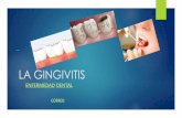 enferLa gingivitis