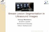 Breast Lesion Segmentation in Ultrasound Images