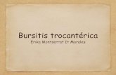 18 bursitis trocantérica