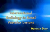 Interventional radiology in renal vascular lesionss