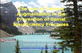 The role of Cement Augmentation in the Prevention of Spinal Insufficiency Fractures