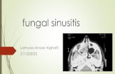 Fungal sinusitis