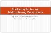 Bradyarrhythmias and malfunctioning pacemakers