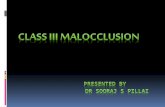 Class III malocclusion by sooraj s pillai