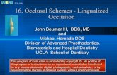 16.occlusal schemes   lingualized occlusion
