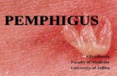 Pemphigus (Bullous Disease)