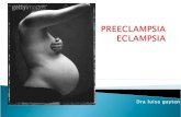 Preeclampsia eclampsia-1206582774130858-4