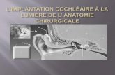 Implantation cochléaire anatomie chirurgicale