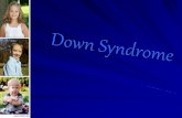 Down syndrome Power Poiny (Biology)
