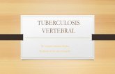 Tuberculosis vertebral (Mal de Pott)
