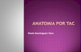 Anatomia por Tomografia Axial computarizada TAC