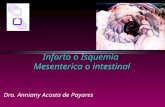 187 - Isquemia mesenterica