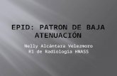 EPID: PATRON DE BAJA ATENUACION EN TEM TORAXICA