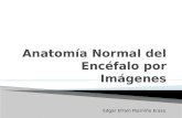 Anatomía normal del encéfalo por imágenes