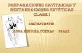 Preparaciones Cavitarias Esteticas De Clase I Odo 062 Uce 2010