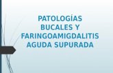 Patologías bucales y Faringoamigdalitis Aguda Supurada. Lucía Flores, Rodrigo Fonseca, Willington Fernández. Dr. Guillermo Fonseca Risco