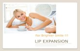 Lip Fusion |Lip Fusion Reviews |Lip Fusion - Lip Plumper