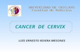 Cancer de cervix lucho