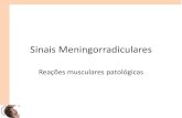 Sinais meningorradiculares