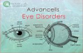 Eye disorders ppt