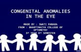 Congenital anomalies in the eye