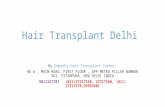 Hair transplant delhi