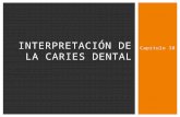 interpretaciones rx cariesInterpretaciondelacariesdentalexpofinalmajo 131022223426-phpapp02