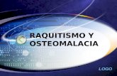 Raquitismo y osteomalacia