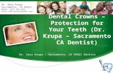 Dental Crowns – Protection for Your Teeth (Dr. Krupa – Sacramento CA Dentist)