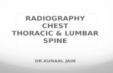 RADIOGRAPHY OF CHEST AND SPINE