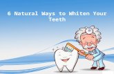 6 Natural ways to whiten your teeth
