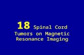 18 spinal cord tumors on magnetic resonance imaging