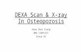 DEXA Scan & X-ray in Osteoporosis