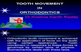 Tooth Movement in Orthodontics