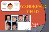 Dysmorphic Child
