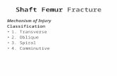 Shaft Femur Fracture