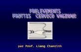 Prelevements Cervico - Vaginaux 08