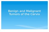 Benign and Malignant Tumors of the Cervix