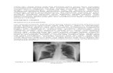 Terjemahan Jurnal - Pneumonia Pada Pasien Imunokompeten