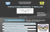 Fx Nasal y Malar