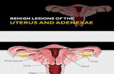 Benign Lesions of the Uterus and Adnexa 2012