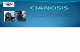 CIANOSIS 2