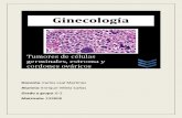 Tumores de Celulas Germinales, Estromales y de Cordon Ovarico.