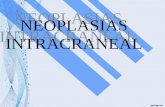 1. Neoplasias intracraneales 2012