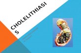 Case Cholelithiasis