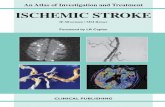 Ischemic Stroke an Atlas of Investigation and Treatment (Atlases of Investigation and Management)