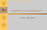 Dermatitis Solar o Prurigo Actinico