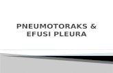 Pneumotoraks & Efusi Pleura 2