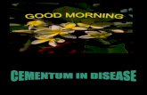 Cementum in Disease[Nalini]